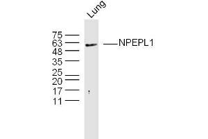 Mouse lung lysates probed with NPEPL1 Polyclonal Antibody, Unconjugated  at 1:300 overnight at 4˚C. (NPEPL1 抗体  (AA 371-470))