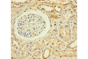 Immunohistochemistry of paraffin-embedded human kidney tissue using ABIN7176159 at dilution of 1:100 (ZNF221 抗体  (AA 1-300))