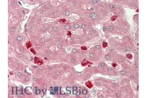 IHC-P analysis of Human Liver Tissue, with HE staining. (CHI3L1 抗体  (AA 112-377))