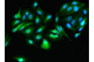 Immunofluorescence staining of HepG2 cells with ABIN7144729 at 1:166, counter-stained with DAPI. (GOT1 抗体  (AA 2-411))