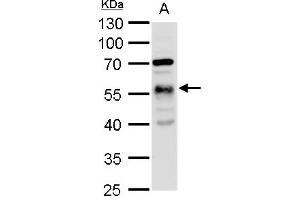 WB Image alpha Tubulin 1A antibody detects alpha Tubulin 1A protein by western blot analysis. (TUBA1A 抗体)