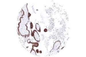 Strong papp A immunostaining of trophoblast cells of a first trimenon placenta (PAPPA 抗体  (AA 351-523))
