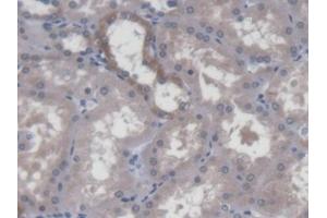 DAB staining on IHC-P; Samples: Human Kidney Tissue (DPPA3 抗体  (AA 1-159))
