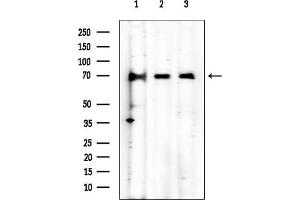 anti-CDK5 Regulatory Subunit Associated Protein 1 (CDK5RAP1) (C-Term) antibody