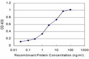 Detection limit for recombinant GST tagged RCV1 is approximately 0. (Recoverin 抗体  (AA 101-199))