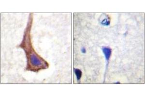 Immunohistochemistry analysis of paraffin-embedded human brain tissue, using CSFR (Ab-561) Antibody. (CSF1R 抗体  (AA 531-580))