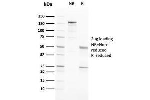 SDS-PAGE Analysis Purified PAPP-A Mouse Monoclonal Antibody (PAPPA/2717). (PAPPA 抗体  (AA 351-523))