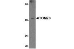 Image no. 1 for anti-Translocase of Outer Mitochondrial Membrane 70 (TOMM70A) (N-Term) antibody (ABIN341709) (TOM70 抗体  (N-Term))