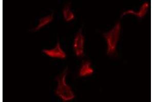 ABIN6278598 staining Hela by IF/ICC. (NOX1 抗体  (C-Term))