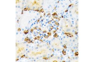 Immunohistochemistry of paraffin-embedded red blood cell staining in rat kidney using Hemoglobin subunit alpha (HB) (HB) Rabbit mAb (ABIN7267608) at dilution of 1:100 (40x lens). (HBA1 抗体)