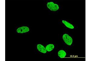 Immunofluorescence of monoclonal antibody to RUNX2 on U-2 OS cell. (RUNX2 抗体  (AA 251-350))