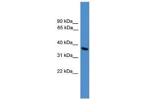 WB Suggested Anti-UCHL5 Antibody Titration: 0. (UCHL5 抗体  (C-Term))