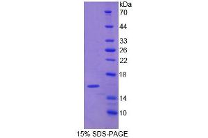 SDS-PAGE analysis of Rat CALD Protein. (Caldesmon 蛋白)