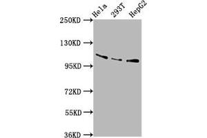 Western Blot Positive WB detected in: Hela whole cell lysate, 293T whole cell lysate, HepG2 whole cell lysate All lanes: AASS antibody at 5. (AASS 抗体  (AA 224-364))