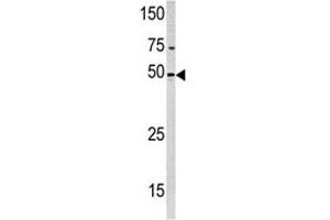 Western blot analysis of PXK antibody and HeLa lysate (PXK 抗体  (AA 221-251))