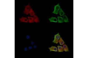 Phospho-ILK (Thr173) Antibody staining HepG2 cells(serum starvation treatment) by IF/ICC. (ILK 抗体  (pThr173))