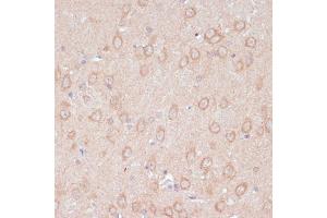 Immunohistochemistry of paraffin-embedded rat brain using D antibody (ABIN7265495) at dilution of 1:100 (40x lens). (ARL4D 抗体  (AA 92-201))