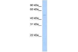 WB Suggested Anti-Pias2 Antibody Titration:  0. (PIAS2 抗体  (C-Term))
