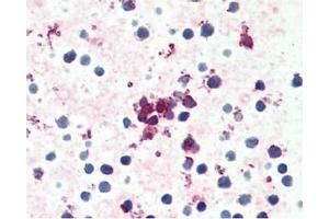 Image no. 1 for anti-Chemokine (C-C Motif) Receptor 4 (CCR4) (C-Term) antibody (ABIN488046) (CCR4 抗体  (C-Term))