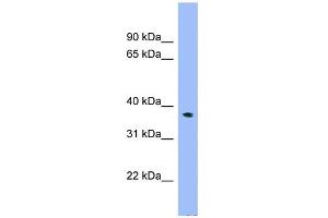 WB Suggested Anti-C17orf48 Antibody Titration: 0. (ADPRM 抗体  (N-Term))
