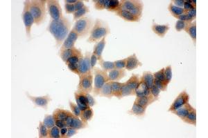 IHC analysis of FASN using anti-FASN antibody . (Fatty Acid Synthase 抗体  (AA 1-226))