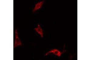 ABIN6266468 staining HepG2 cells by IF/ICC. (EPS15 抗体  (pTyr849))