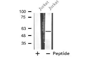 Western blot analysis of extracts from Jurkat cells, using MATK antibody. (MATK 抗体  (Internal Region))