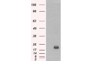 HEK293 overexpressing BAALC and probed with ABIN2561308 (mock transfection in first lane). (BAALC 抗体  (Internal Region))