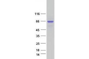 Western Blotting (WB) image for Alkaline Phosphatase, Liver/bone/kidney (ALPL) (Transcript Variant 1) protein (Myc-DYKDDDDK Tag) (ABIN2714570)