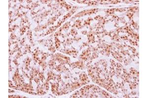 Image no. 1 for anti-Fanconi Anemia, Complementation Group E (FANCE) (AA 205-482) antibody (ABIN1498219) (FANCE 抗体  (AA 205-482))