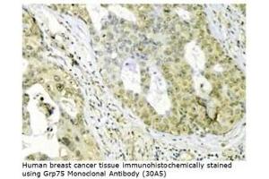 Image no. 1 for anti-Heat Shock 70kDa Protein 9 (Mortalin) (HSPA9) antibody (ABIN364088) (HSPA9 抗体)