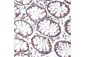 Immunohistochemistry of paraffin-embedded human colon using SMURF2 Rabbit mAb (ABIN1680578, ABIN3015927, ABIN3015928 and ABIN7101462) at dilution of 1:100 (40x lens). (SMURF2 抗体)