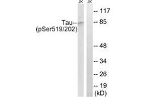 Western blot analysis of extracts from Jurkat cells treated with H2O2 100uM 30', using Tau (Phospho-Ser519/202) Antibody. (tau 抗体  (pSer519))