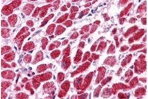Human Heart: Formalin-Fixed, Paraffin-Embedded (FFPE) (SNF8 抗体  (N-Term))