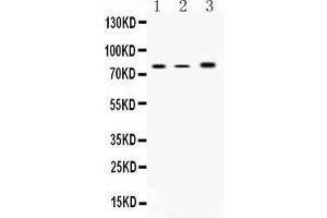 Western blot analysis of 12 Lipoxygenase using anti-12 Lipoxygenase antibody . (ALOX12 抗体  (N-Term))