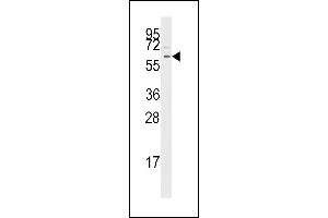 Western blot analysis of anti-TGFBR1 Pab (ABIN392279 and ABIN2841947) in Jurkat cell line lysates (35 μg/lane). (TGFBR1 抗体  (AA 134-163))