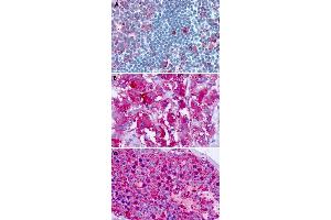 Immunohistochemical staining of formalin-fixed paraffin-embedded human tonsil (A), adrenal gland (B) and testis (C) with CELSR1 polyclonal antibody . (CELSR1 抗体  (C-Term))
