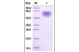 Human IL-1RL1, His Tag on SDS-PAGE under reducing (R) condition. (IL1RL1 Protein (AA 19-328) (His tag))