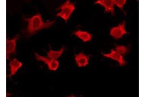 ABIN6277419 staining HepG2 by IF/ICC. (P2RY11 抗体)