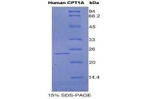 SDS-PAGE (SDS) image for Carnitine Palmitoyltransferase 1A (Liver) (CPT1A) (AA 191-353) protein (His tag) (ABIN1981179)