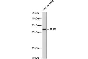 Western blot analysis of extracts of mouse lung, using SRSF2 antibody (ABIN1682677, ABIN3017915, ABIN3017916, ABIN5664377 and ABIN6220303) at 1:1000 dilution. (SRSF2 抗体  (AA 1-75))