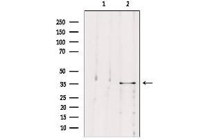 Western blot analysis of extracts from B16F10, using MAST4 Antibody. (MAST4 抗体  (N-Term))