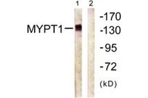 Western blot analysis of extracts from COS7 cells, using MYPT1 (Ab-696) Antibody. (PPP1R12A 抗体  (AA 661-710))