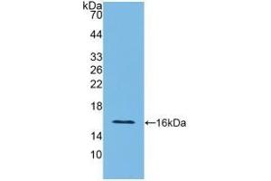 Detection of Recombinant IFNg, Rat using Polyclonal Antibody to Interferon Gamma (IFNg) (Interferon gamma 抗体  (AA 23-156))