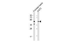 All lanes : Anti-KIST Antibody  at 1:1000 dilution Lane 1: human skeletal muscle lysate Lane 2: A-673 whole cell lysate Lysates/proteins at 20 μg per lane.