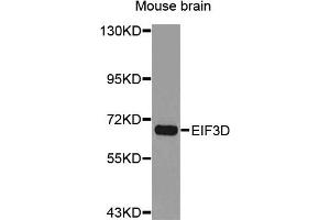 Western Blotting (WB) image for anti-Eukaryotic Translation Initiation Factor 3, Subunit D (EIF3D) antibody (ABIN1876976) (EIF3D 抗体)