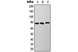 Western blot analysis of NDUFS1 expression in HeLa (A), SP2/0 (B), PC12 (C) whole cell lysates. (NDUFS1 抗体  (C-Term))