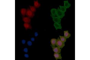 ABIN6255486 and ABIN6277780 staining Hela cells(30 min of UV treatment) by IF/ICC.