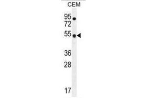 Western blot analysis using TBC1D13 Antibody (Center) Cat.