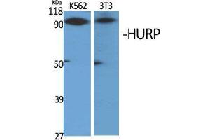 Western Blot (WB) analysis of specific cells using HURP Polyclonal Antibody. (DLGAP5 抗体  (C-Term))